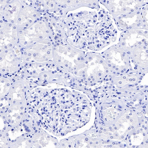 TRPS1 Recombinant Rabbit mAb (S-765-3)