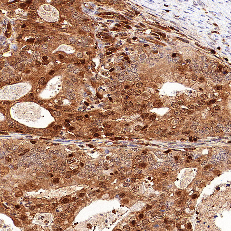 PSMB9 Recombinant Rabbit mAb (S-4183-122)