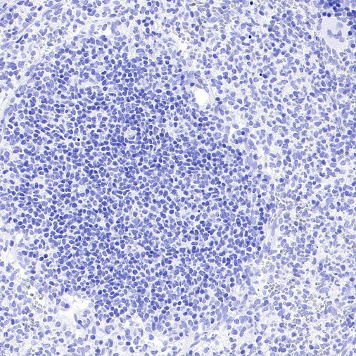Pan Trk Recombinant Rabbit mAb (SDT-400-39)