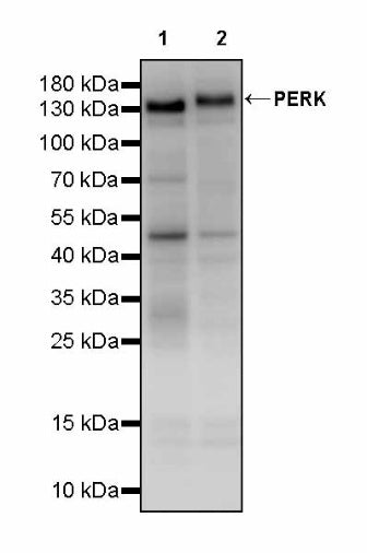PERK Recombinant Rabbit mAb (S-2822-52)