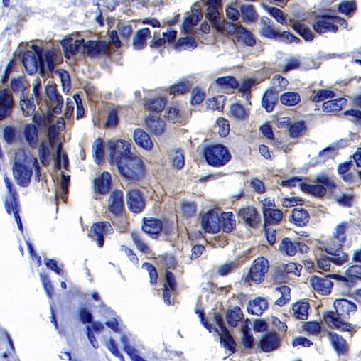 ErbB3 Recombinant Rabbit mAb (SDT-991-73-2)