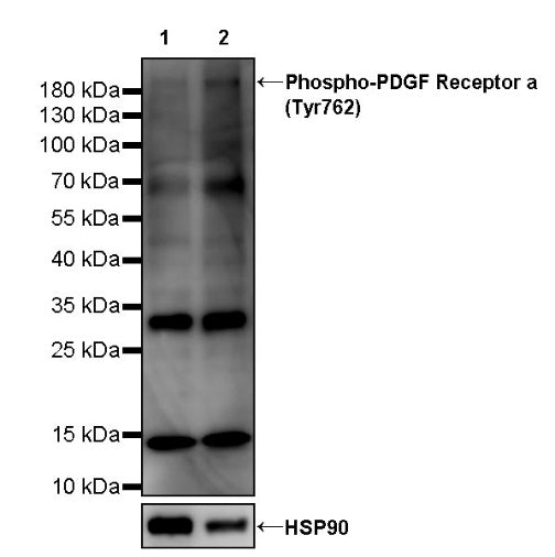 Phospho-PDGF Receptor α (Tyr762) Recombinant Rabbit mAb (S-3423)