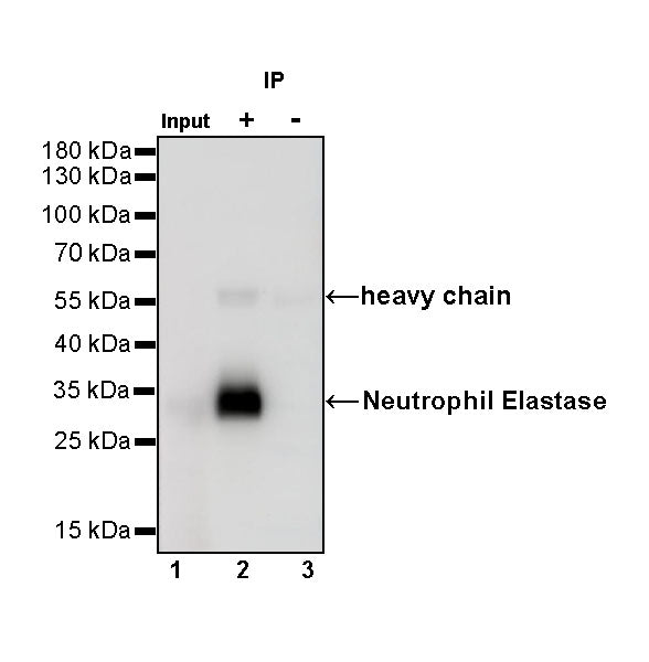 Neutrophil Elastase Recombinant Rabbit mAb (S-R230)