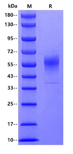 Human PLA2G7, His tag