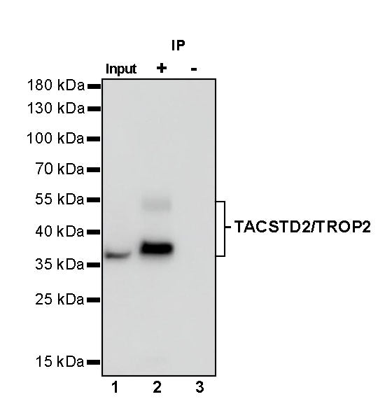 TACSTD2/TROP2 Recombinant Rabbit mAb (S-R237)