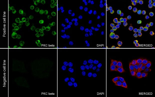 PKC beta Recombinant Rabbit mAb (S-3158-28)