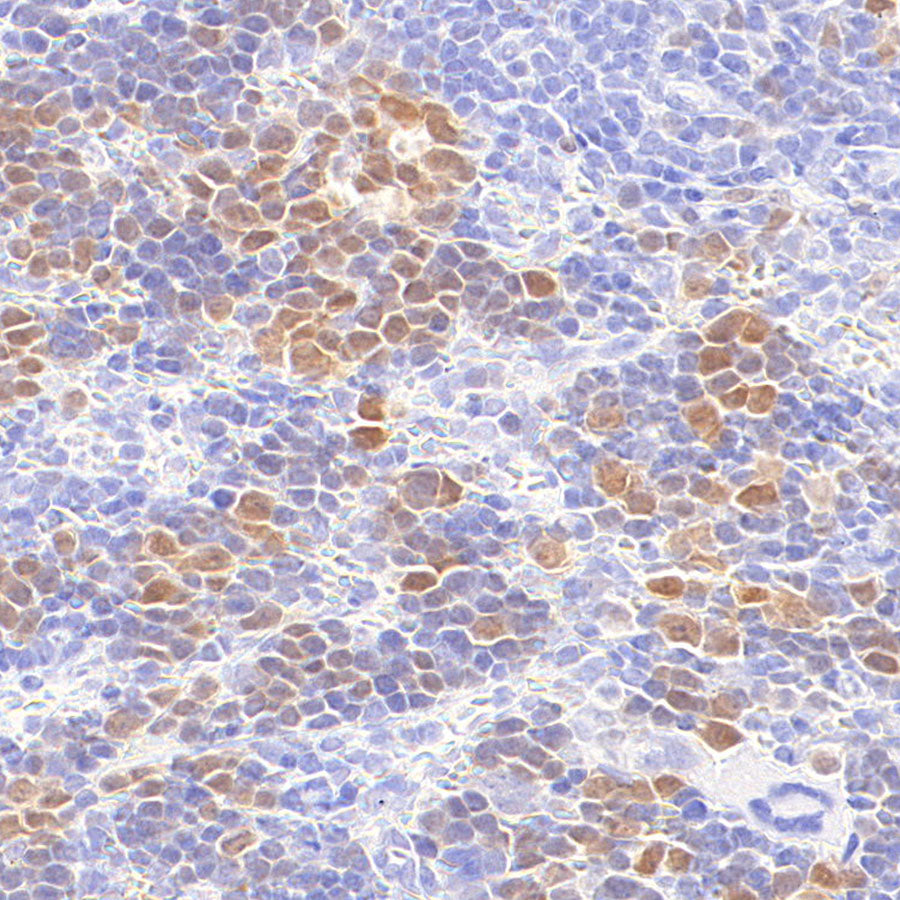 Chk1 Recombinant Mouse mAb (S-6263)