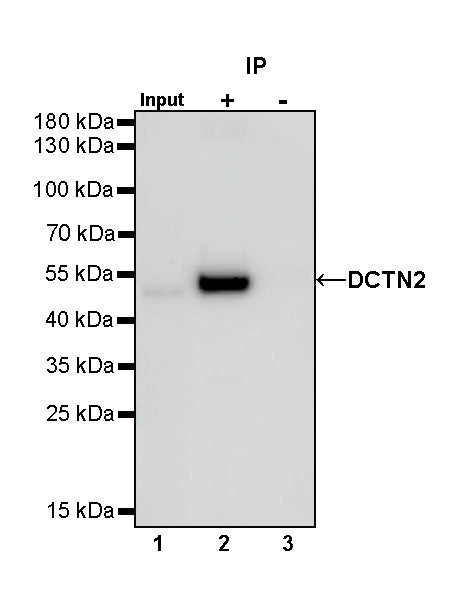 DCTN2 Recombinant Rabbit mAb (S-1082-7)