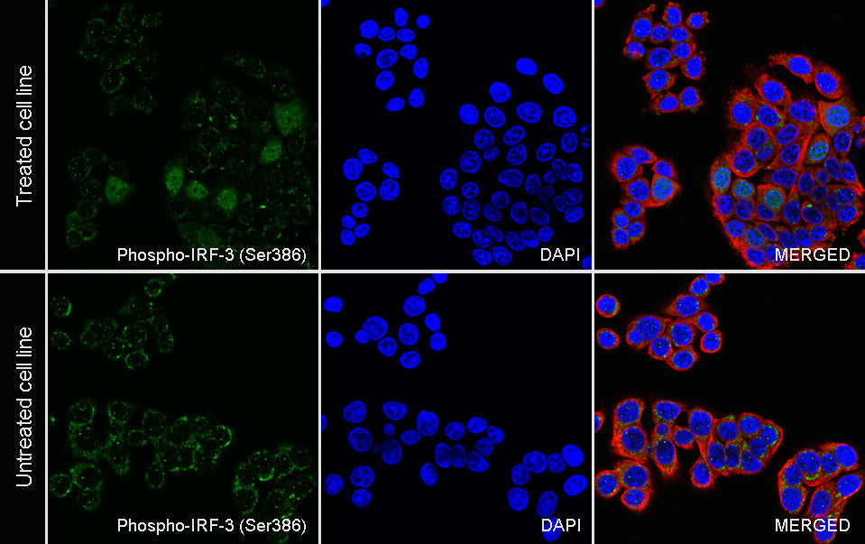 Phospho-IRF3 (Ser386) Recombinant Rabbit mAb (S-3498)