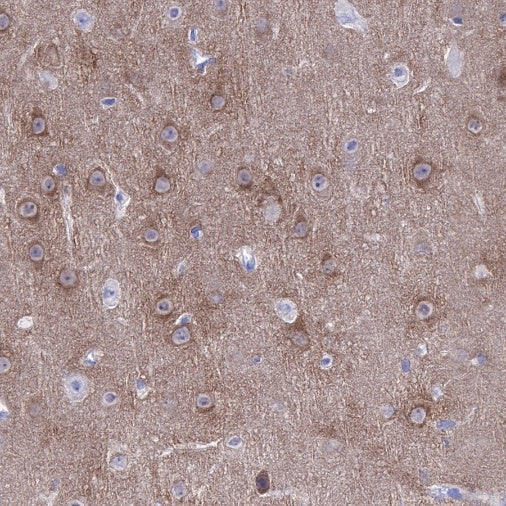 CaMKII-α/β Recombinant Rabbit mAb (S-R329)