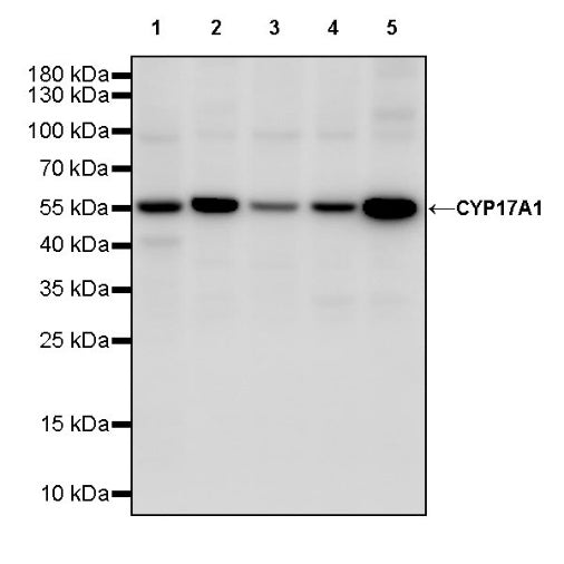 CYP17A1 Recombinant Rabbit mAb (S-1961-49)