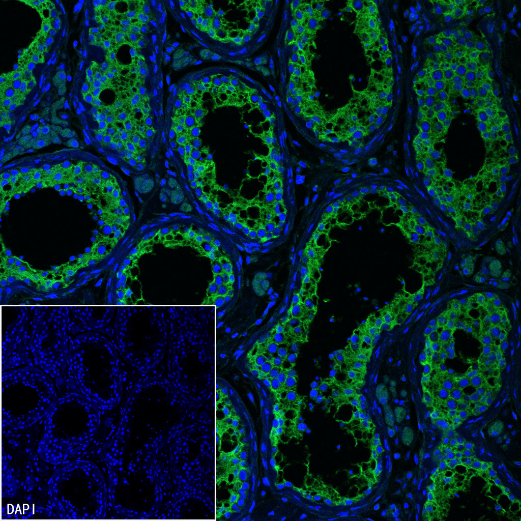 Vinculin Recombinant Rabbit mAb (S-5405)