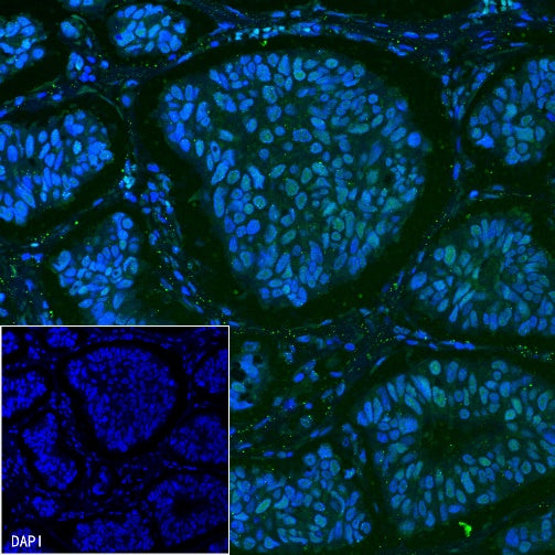 Estrogen Receptor α Recombinant Rabbit mAb (Alexa Fluor® 488 Conjugate) (SDT-R371)