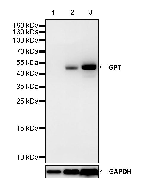 GPT Rabbit Polyclonal Antibody