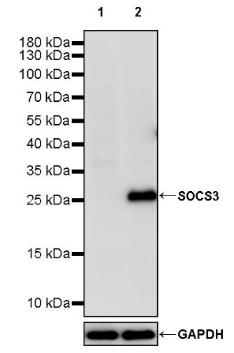 SOCS3 Recombinant Rabbit mAb (S-2238-34)