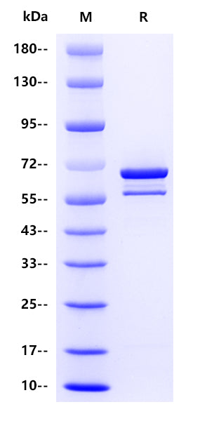 Influenza B virus NP(strainB/Victoria/1308/2005), His tag