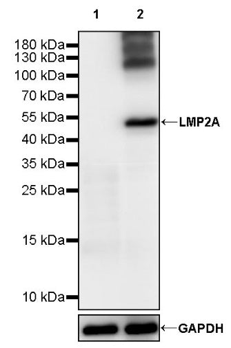 LMP2A Recombinant Rabbit mAb (S-2247-41)