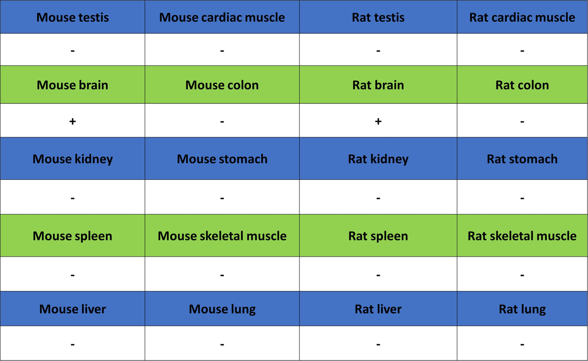AP-2α Recombinant Rabbit mAb (S-4444-44)