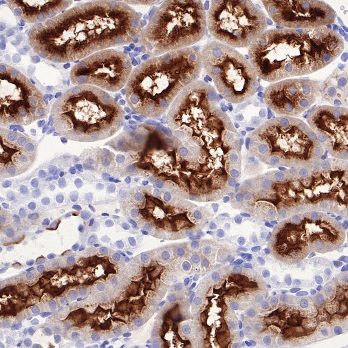 Human folate receptor alpha Recombinant Rabbit mAb (SDT-719-20-2)
