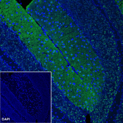 Vesicular Glutamate Transporter 1 (VGLUT1) Recombinant Rabbit mAb (S-1118-58)