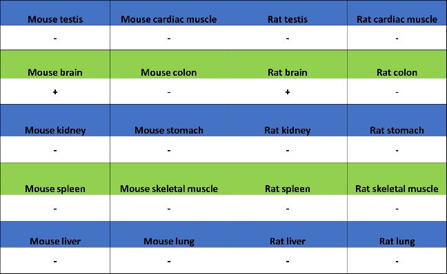 GABRD Recombinant Rabbit mAb (S-1584-162)