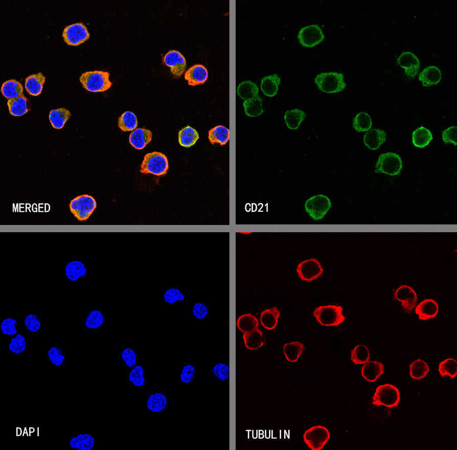 S-RMab® CD21 Recombinant Rabbit mAb(SDT-007-47)