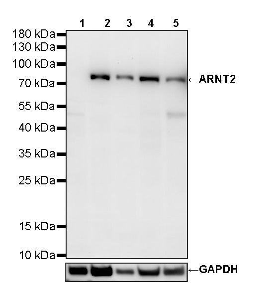 ARNT2 Recombinant Rabbit mAb (S-4087-5)
