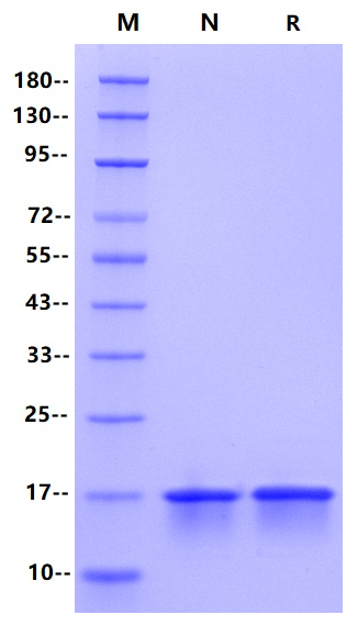 Nucleocapsid CTD His Tag, SARS-CoV-2