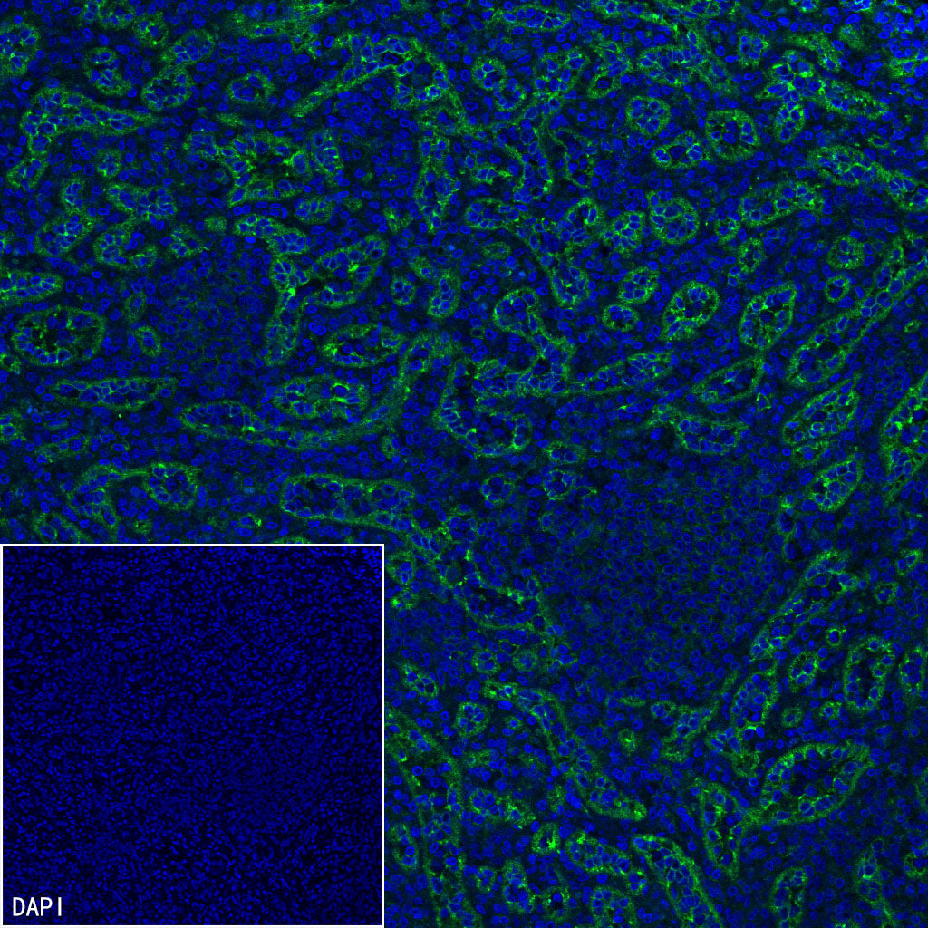 EPCR/PROCR (CD201) Rabbit Polyclonal Antibody