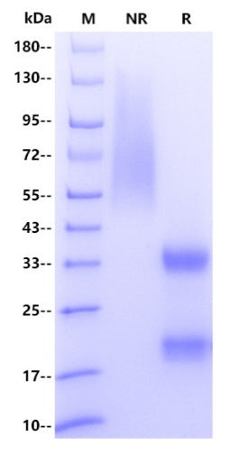 Human HCG/CGA&CGB Protein, His tag