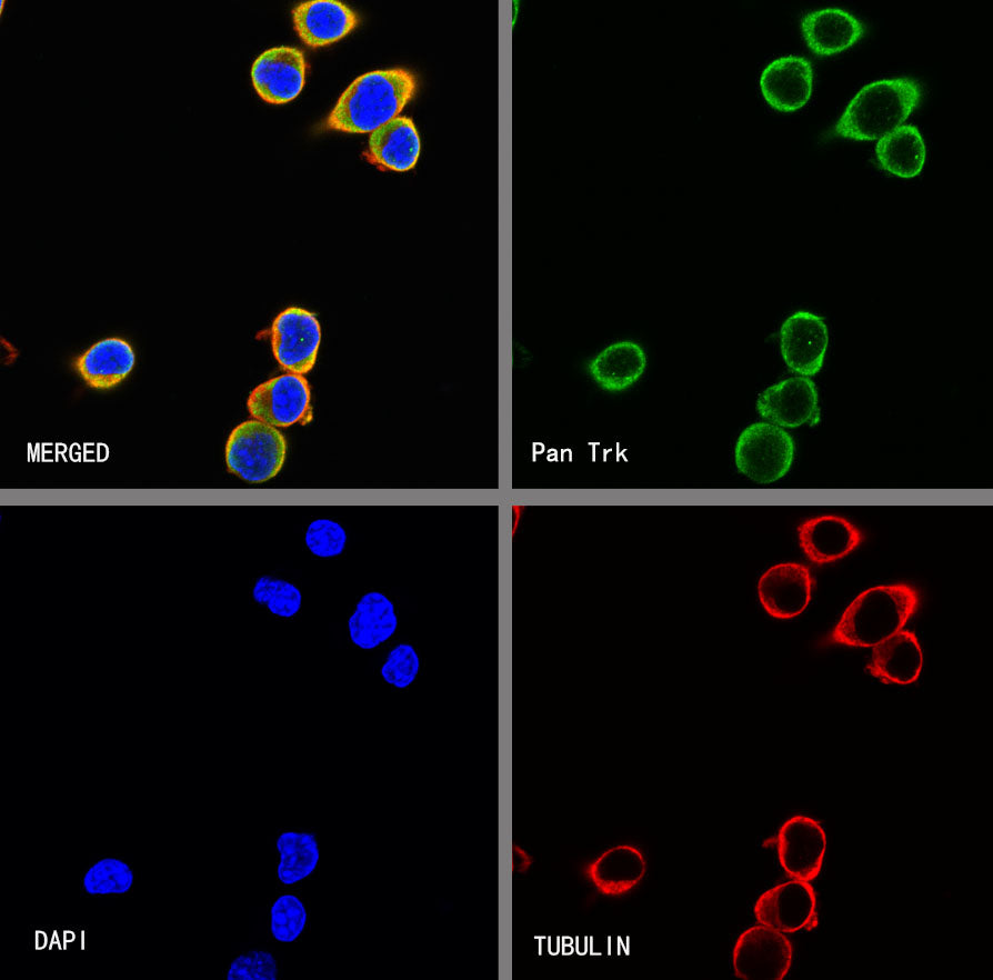 S-RMab® Pan Trk Recombinant Rabbit mAb (SDT-512-5)