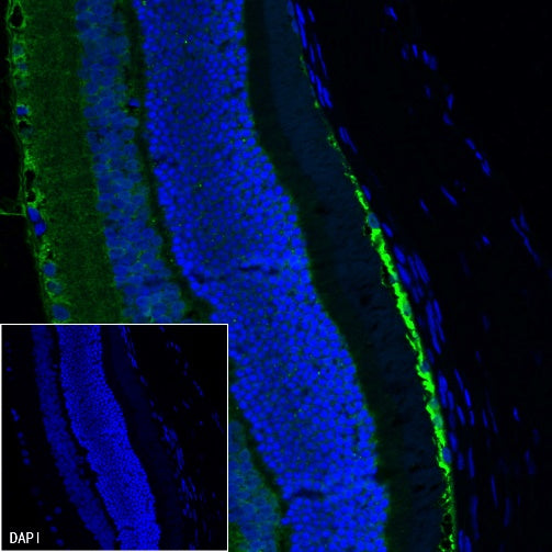 CRALBP Rabbit Polyclonal Antibody