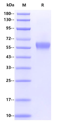 Human NPTX2 Protein, His Tag
