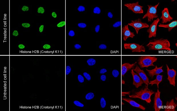 Histone H2B (Crotonyl K11) Recombinant Rabbit mAb (S-R420)