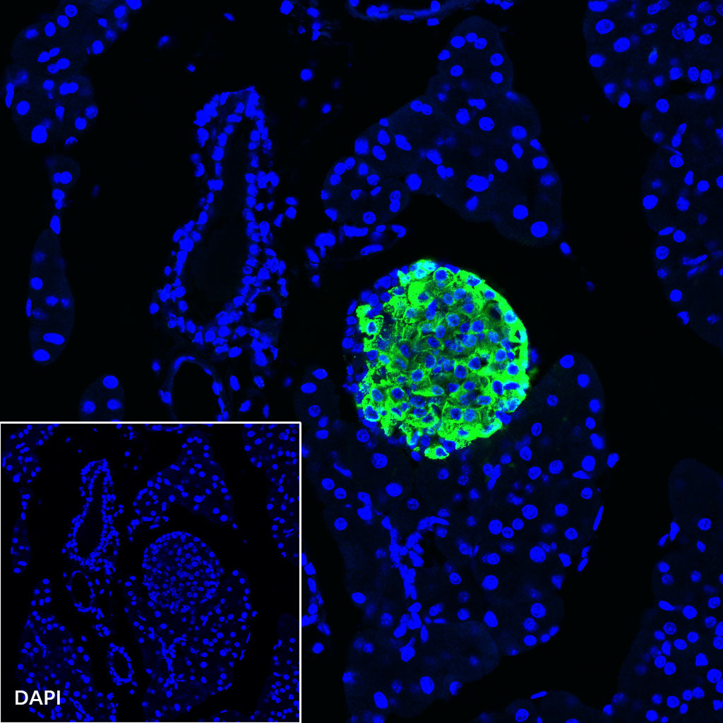 Insulin Recombinant Rabbit mAb (SDT-026-17)