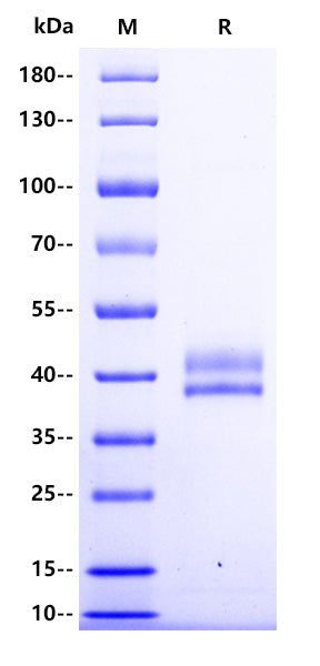 Human Factor H-related 1/CFHR1 Protein, His Tag