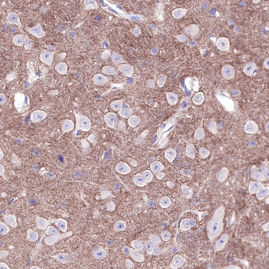 CD81 Recombinant Rabbit mAb (SDT-144-22)