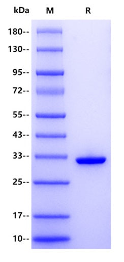 Human YWHAE/14-3-3 epsilon Protein, His Tag