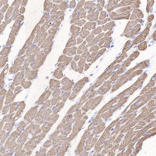 Myosin light chain 3 Recombinant Rabbit mAb (S-664-75)