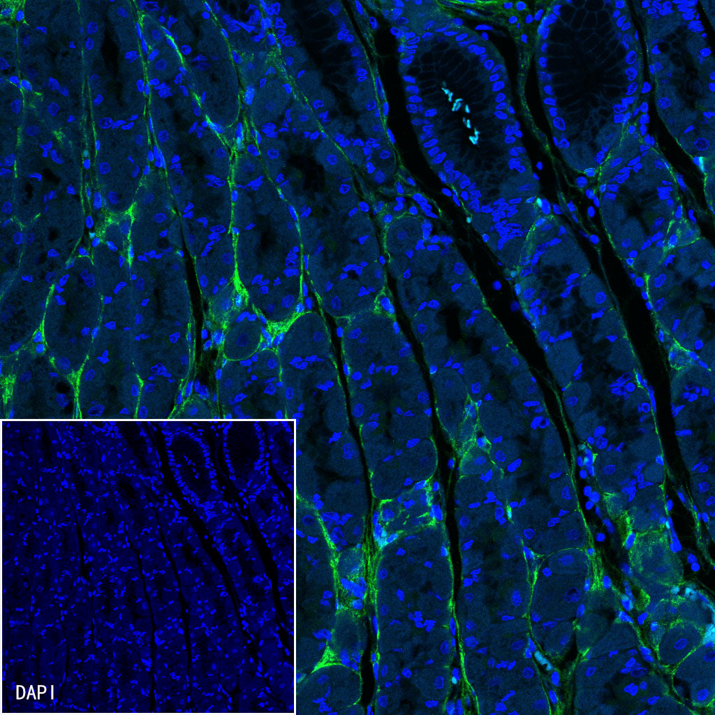 COL3A1(PIIINP) Recombinant Rabbit mAb (SDT-149-50)