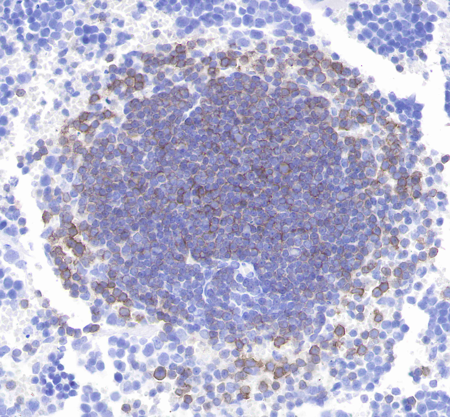 CD21 Recombinant Rabbit mAb (SDT-007-36)
