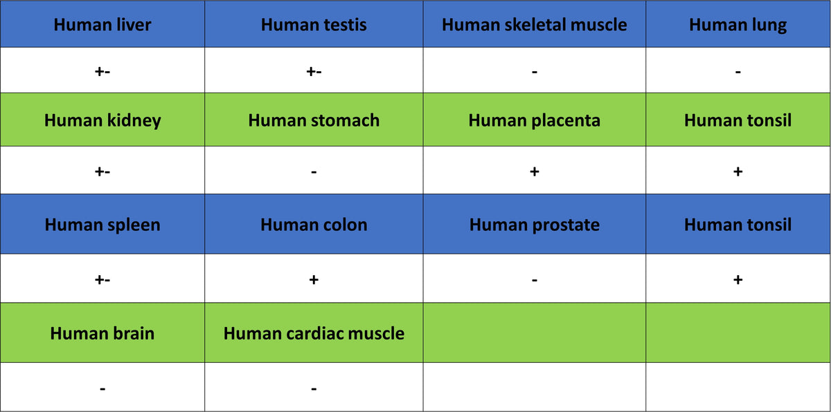 SPTLC1 Recombinant Rabbit mAb (S-6028)