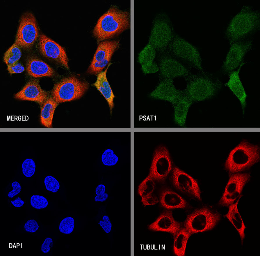 PSAT1 Recombinant Rabbit mAb (S-3054-5)