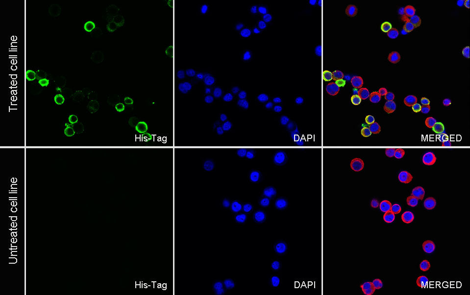 His tag Recombinant Rabbit mAb (S-5315)