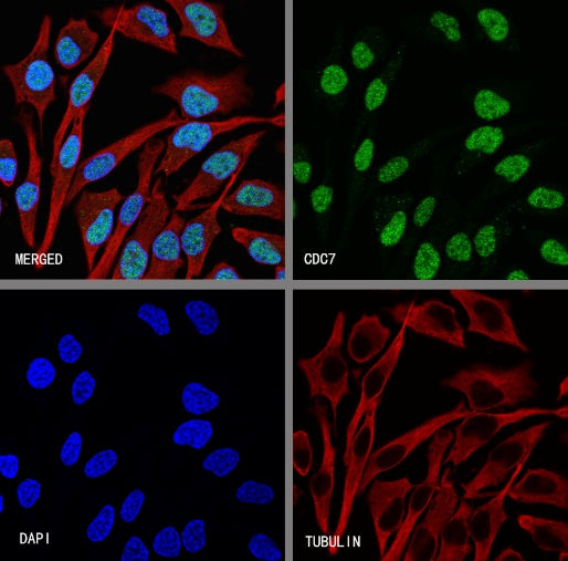 CDC7 Recombinant Rabbit mAb (S-2159-50)