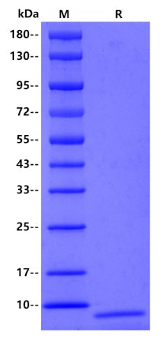 Staphylococcus aureus Protein A (B) His Tag, Human