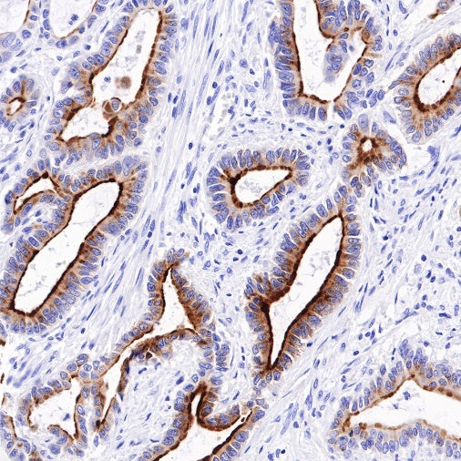 Spink1 Recombinant Rabbit mAb (S-R249)
