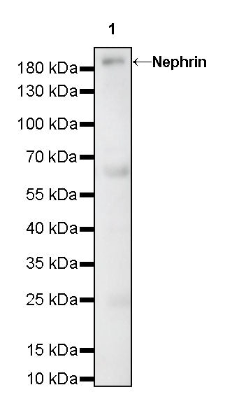 Nephrin Recombinant Rabbit mAb (S-543-63)