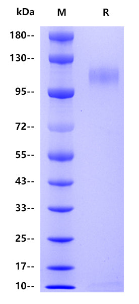 Human sFlt-1 Protein, His Tag