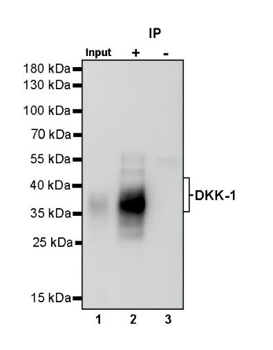 DKK-1 Recombinant Rabbit mAb (S-232-231)